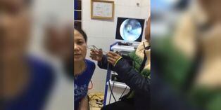 Mujer sufría constantes dolores de cabeza y descubre que una mariposa vivía al interior de su oreja