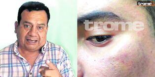 Tony Rosado es acusado de meterle dos puñetazos a exintegrante de su agrupación | FOTOS