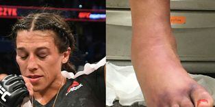UFC: Así terminó el pie de la polaca Joanna tras su pelea con Michelle Waterson ¡Tremendo!